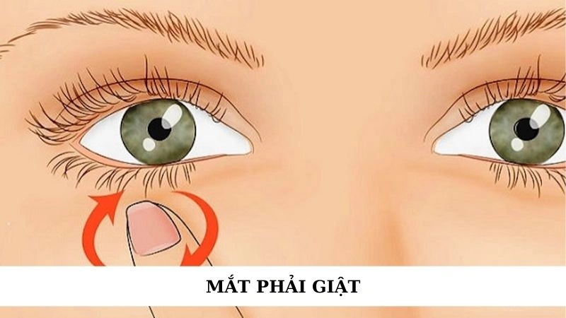 Mắt phải giật báo hiệu điều gì? Con số may mắn nên đánh 1 Mắt phải giật