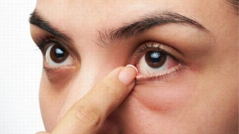 Mắt trái giật hên hay xui? Giải mã điềm báo theo giờ chuẩn 3 Giật mắt trái vào trưa